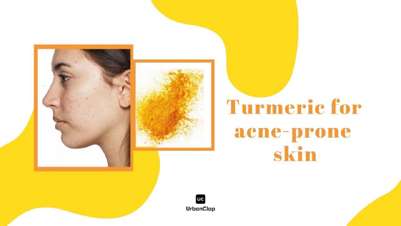 Top 10+ turmeric and honey face mask 5 Turmeric for Acne | 5 DIY Face Masks for Acne